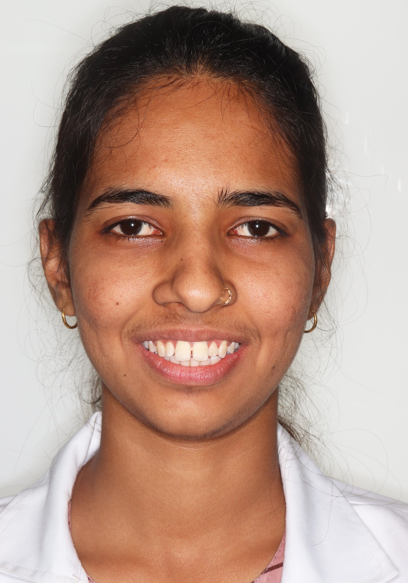 Yogita Before